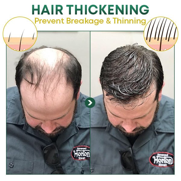 HyunHerb Ginseng - Natuurlijk Serum voor Haarherstel en Groei