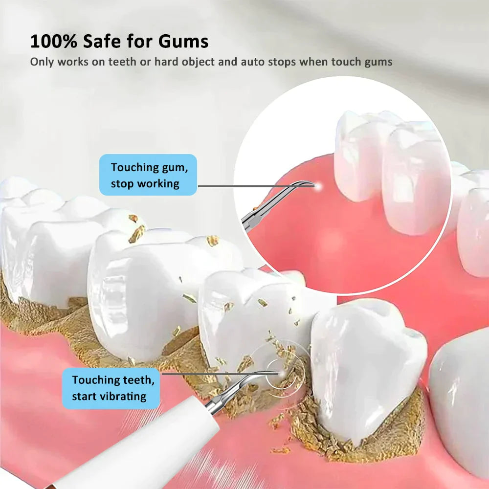 BrightClean - Ultrasone Tandenreiniger voor Grondige Mondverzorging